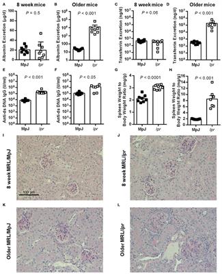 Evidence of Renal Iron Accumulation in a Male Mouse Model of Lupus